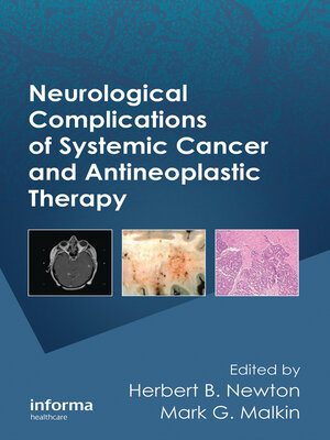 cover image of Neurological Complications of Systemic Cancer and Antineoplastic Therapy